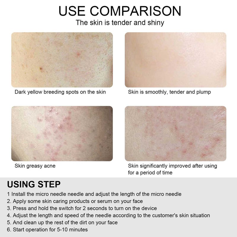 Professional Derma Pen Micro Needle 3 Gears Adjustment Anti Aging