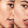 Limpiador Facial Gel E.l.f. Cosmetics Blemish Breakthrou
