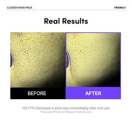 FRANKLY Closer Pore Minimizing Mask – Korean Semi-Gel Face Sheet Mask for Pore Care, Hydration & Firming | Korean Skin Care with Collagen, Triple Hyaluronic Acids & Peptides | 0.74 fl oz, 1pc