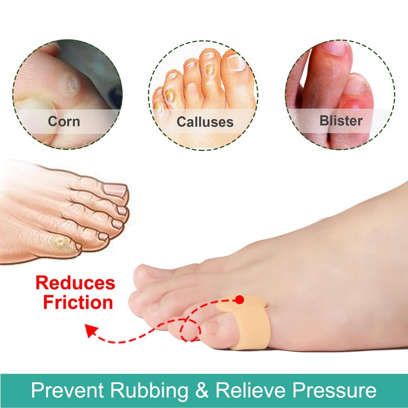 Welnove Gel Toe Separator - 8 Pack Pinky Toe Spacers
