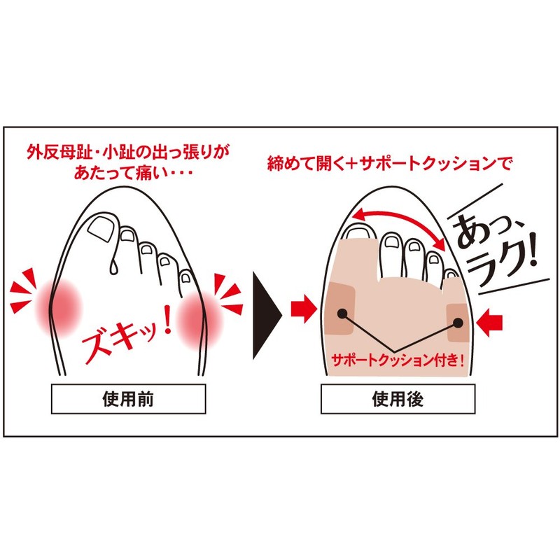 Alphax Foot Supporter, Made in Japan, For Left and Right