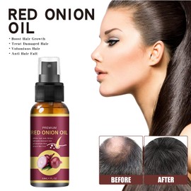 Hair Oil for Hair Care, Hair Growth and Care Serum, Serum for Hair Growth, Onion Hair Serum, Hair Growth Agent, Women, Hair Serum for Fast Growth, Anti Hair Loss Serum, 30 ml