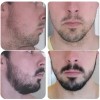 Barba Gel Crema Barba Bigote Barba Oferta Novocrin Barba
