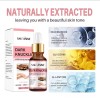 Aromixe 7 Day Whitening Serum 50ml for Knuckles, Feet, Elbows,