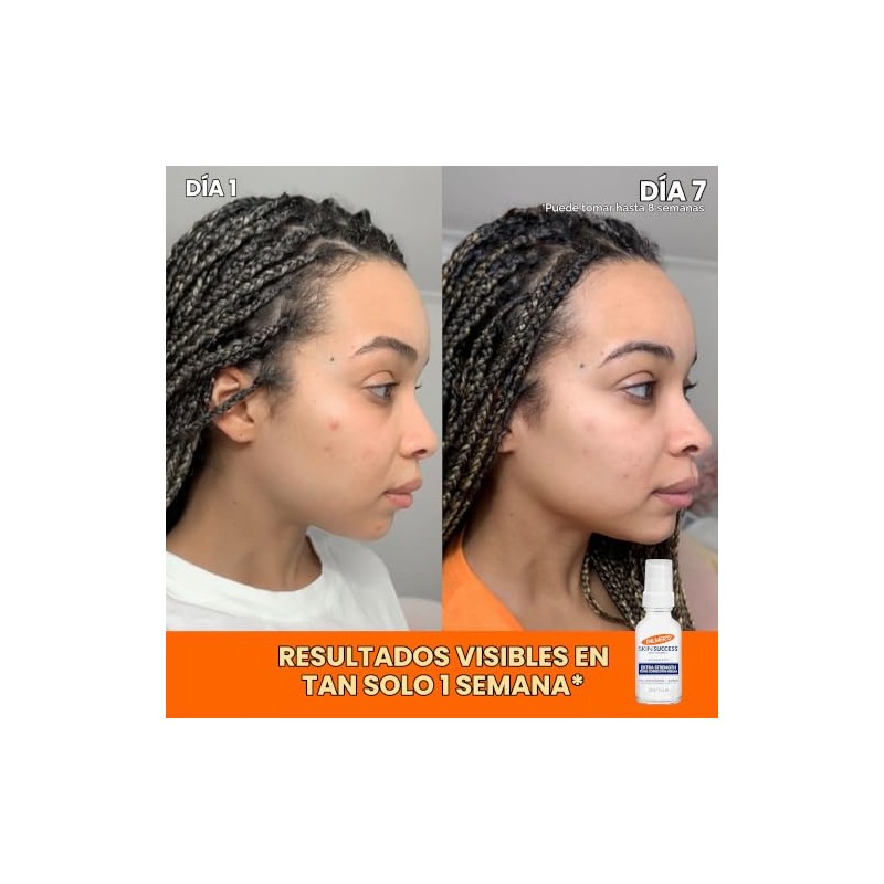 Palmer’s Skin Success Extra Strength Suero Corrector de Tono, Ayuda