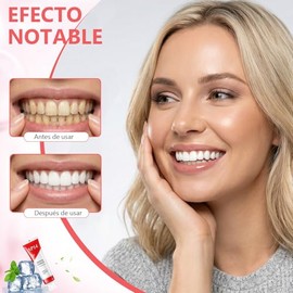 6PCS Pastas Dentales Blanqueadoras SP-14, Pasta de Dientes con Niacinamida para Adultos, Fórmula Mejorada con Probióticos SP-14, Aliento Fresco, Tamaño de Viaje (6PCS)