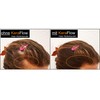 KeraFlow Ansatzpuder, Haar MakeâUp zur Haarverdichter, Haarpulver zum Kaschieren von