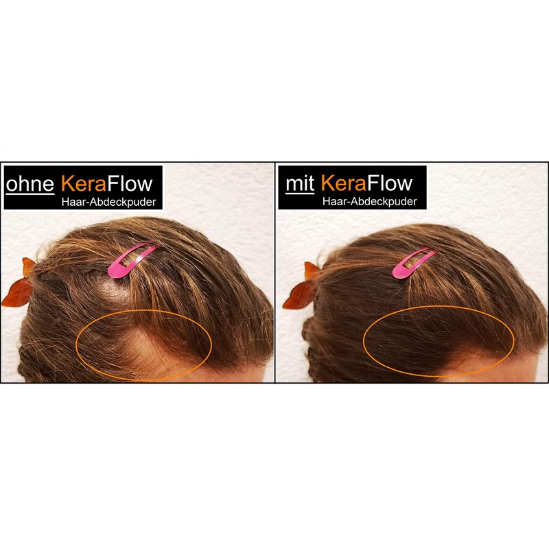 KeraFlow Ansatzpuder, Haar MakeâUp zur Haarverdichter, Haarpulver zum Kaschieren von