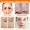 Diamond Microdermabrasion Machine McWdoit 3 in 1 Dermabration Facial Home