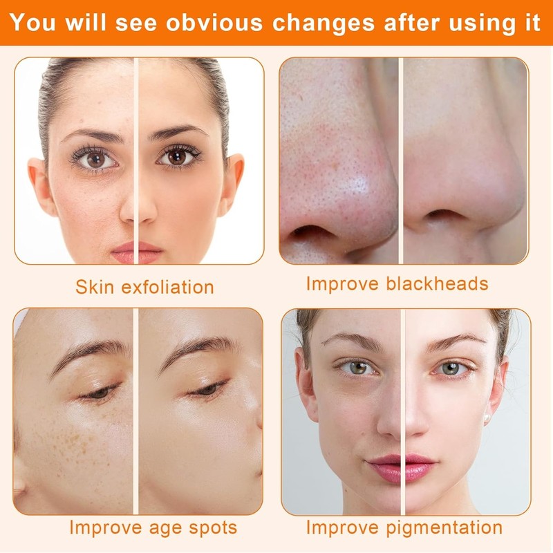 Diamond Microdermabrasion Machine McWdoit 3 in 1 Dermabration Facial Home