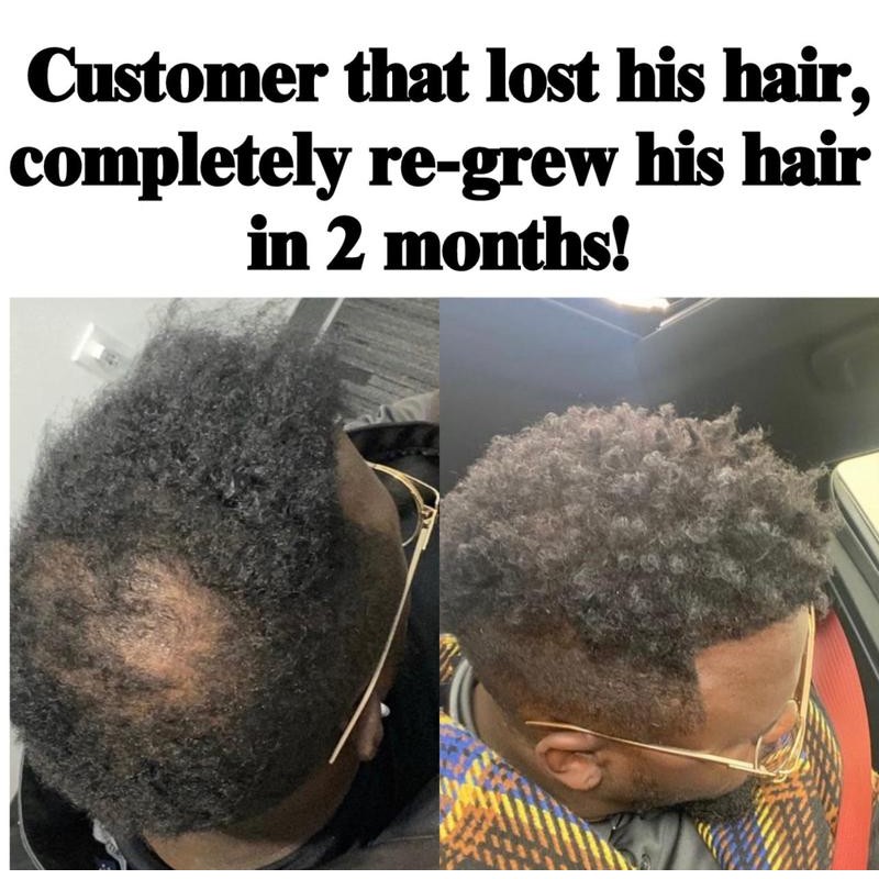 BLAQ LUXURY Mega Gro Repair and Strengthen Hair Serum