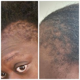 ReGain restore hair growth butter Haircare Aloe Blend Nourishing Aloe Vera Peppermint Comfort Repair Conditioner Oil