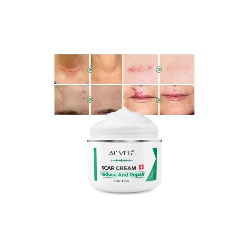 Crema Para Cicatrices, Estrías, Acné, Cacarizos Crema Repara