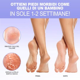 Maschera Esfoliante Piedi, 3 paia JVR Acido Lattico Maschere Peeling Feet, riparazione tallone ruvido, rimozione della pelle morta, desquamazione di calli (Lavanda)