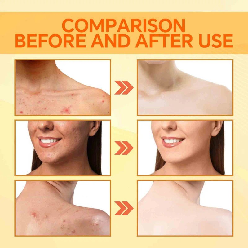 C Jabón, Aceite, Lufa Y Limón Para Limpiar Y Bañar