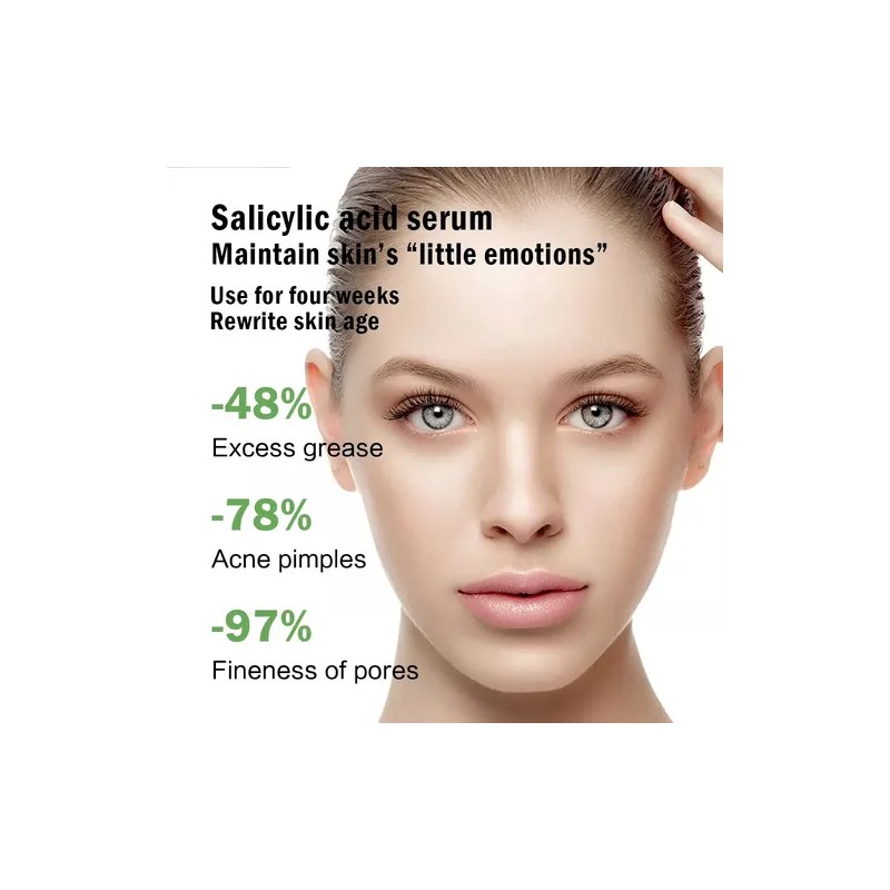 Mopoyat Suero Facial Con Ácido Salicílico 30ml