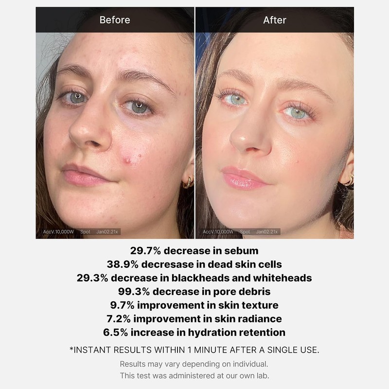 Medicube Exfoliante de Enjuague con ?cido al 21%