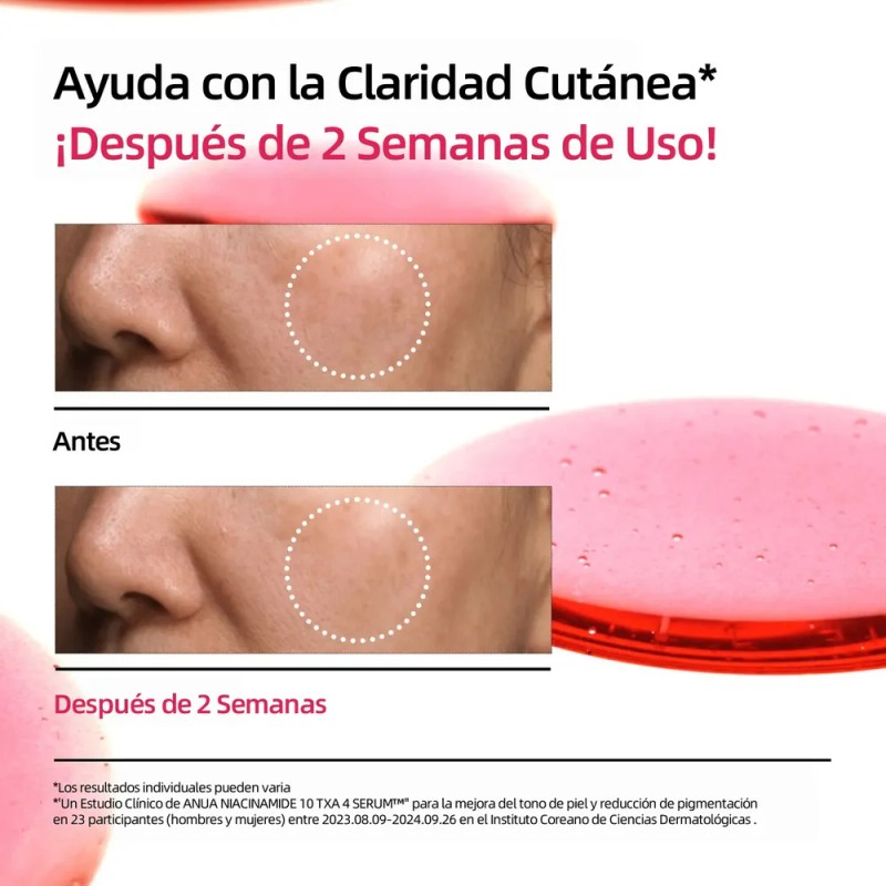 Suero Corrector de Manchas Oscuras ANUA con Niacinamida y TXA