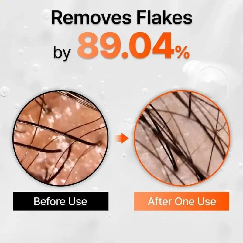 Lilyeve Hair Growth Serum With Brush