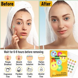 Pimple Patches for Face - 40 Count, Acne Patches Fast Healing Spot Treatment, Hydrocolloid Stickers for Blemish Care, Oil Absorption, Cute Design Pimple Patch for All Skin Types