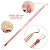 Blackhead Remover Pimple Comedone Extractor Tool Acne Kit - Treatment
