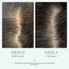 lilyeve [lilyeve]Scalp:Turn Cica PDRN Brush Ampoule 100ml
