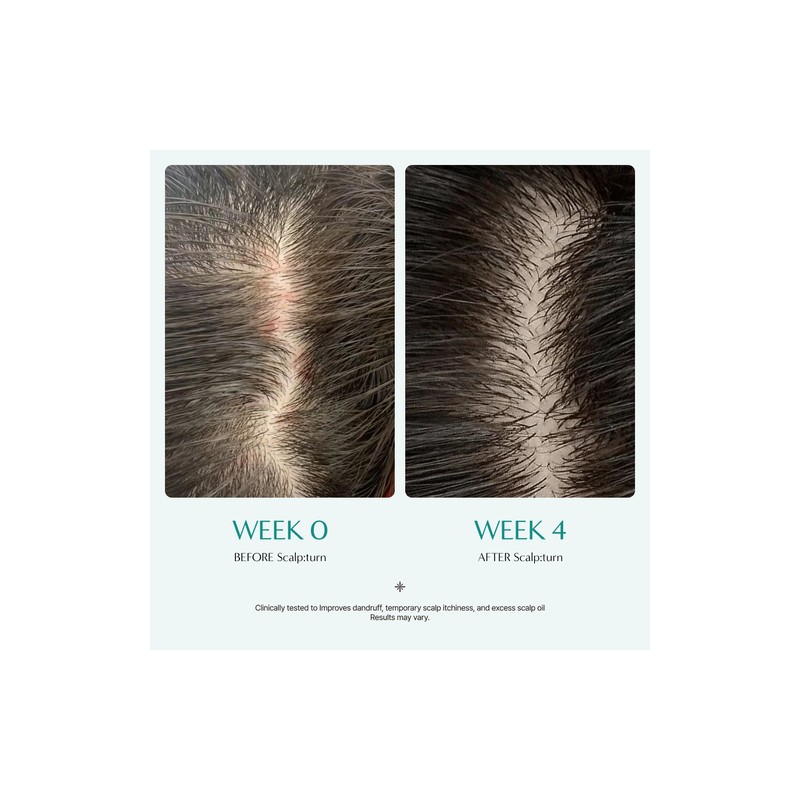 lilyeve [lilyeve]Scalp:Turn Cica PDRN Brush Ampoule 100ml