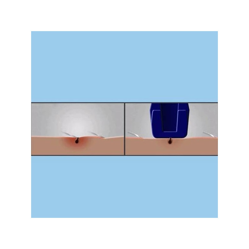 SkinTek Razor Blades 8-Pack / 스킨텍 면도날 8입