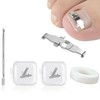 Esshogo 1 Set Ingrown Toenail Tools, Nail Correction Buckle, Patch