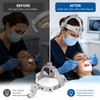 Dental LED Headlight for Binocular Loupes – 5W Adjustable Spot