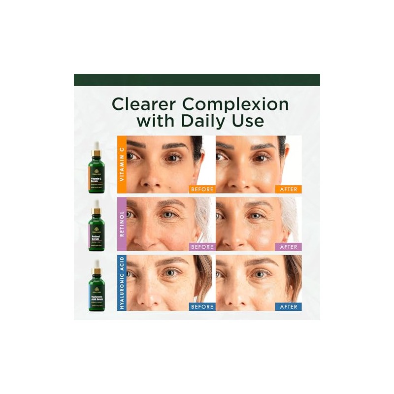 ToLB 72% Organic Anti Aging Serum Combo Pack - Vitamin