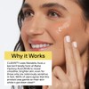 CLEARSTEM - CLEARITY The Blackhead Dissolver Mandelic Acid Serum -