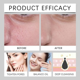 Minimizing Pores & Sebums Face Serum - Oil Control & Dark Spots Minimising Essence - Spicule Calm 1000 Pore-Refine + Heartleaf Extract, Deeply Purifies Pores, Relieve Irritation and Discomfort 30ml