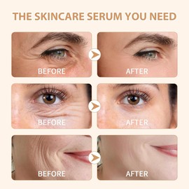 Vitamin C Face Serum With Hyaluronic Acid, Facial Serum with Retinol and Niacinamid, Vitamin C Serum for Face, Hydrating Skin