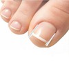 Ingrown toenail protection tips tape, ingrown toenail foot care 10P 6ea