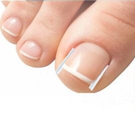 Ingrown toenail protection tips tape, ingrown toenail foot care 10P 6ea