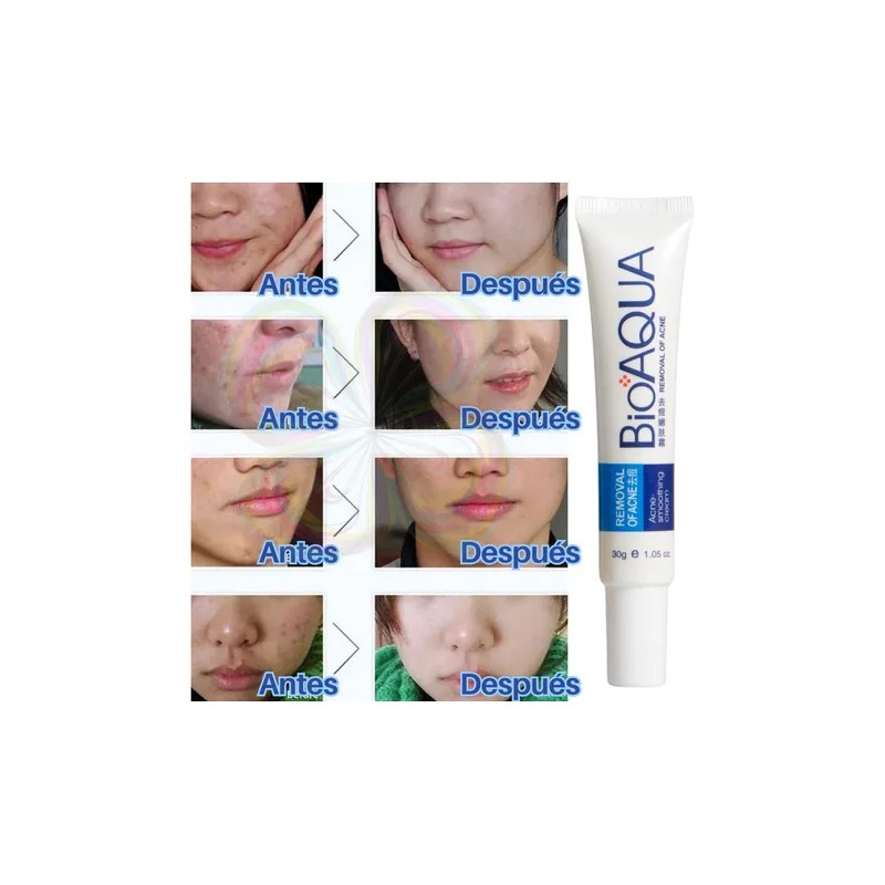 Bioaqua crema antiacné | reduce puntos negros, cicatrices y poros