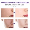 4Pcs Face Clean Gel Perilla Facial Skin Care Cleansing Hydrating