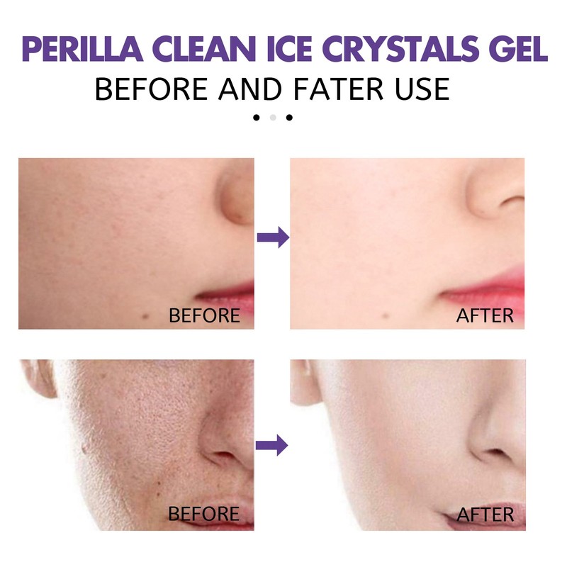 4Pcs Face Clean Gel Perilla Facial Skin Care Cleansing Hydrating