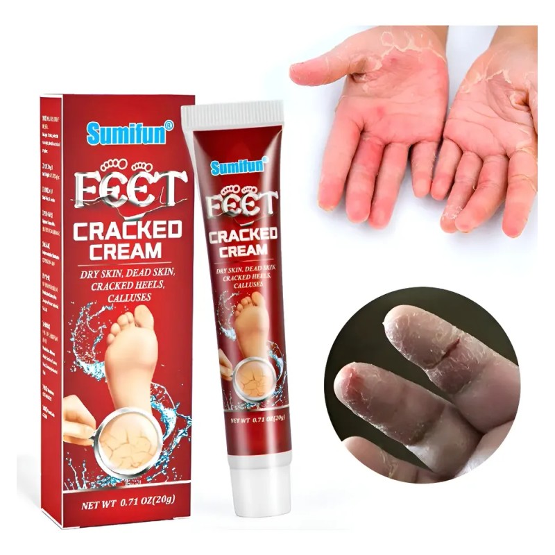 Xt ! Crema Anticongelante Anticongelante For Manos Y Pies /