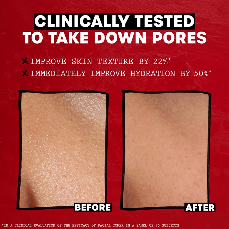 THAYERS Alcohol-Free Rose Petal Witch Hazel Facial Toner for Glowing