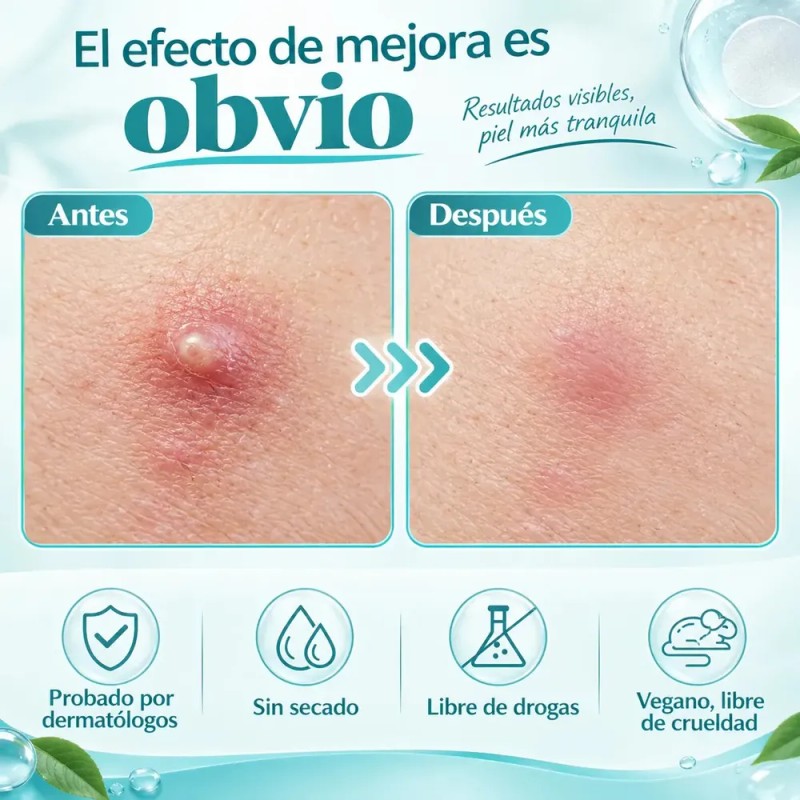 JOVEECO - 720pcs Parches Para Acné Hidrocoloide Absorbe La Grasa,parches