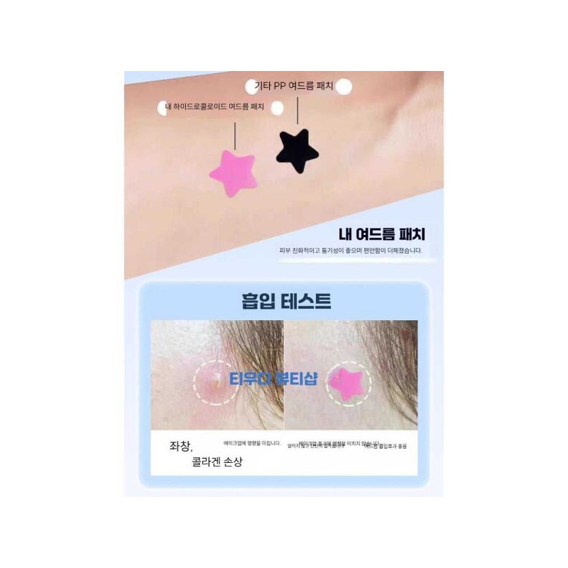 Nokey 노케이 별모양여드름패치 케어 방수 스팟패치 여드름 [검은색 40개입/총 5매