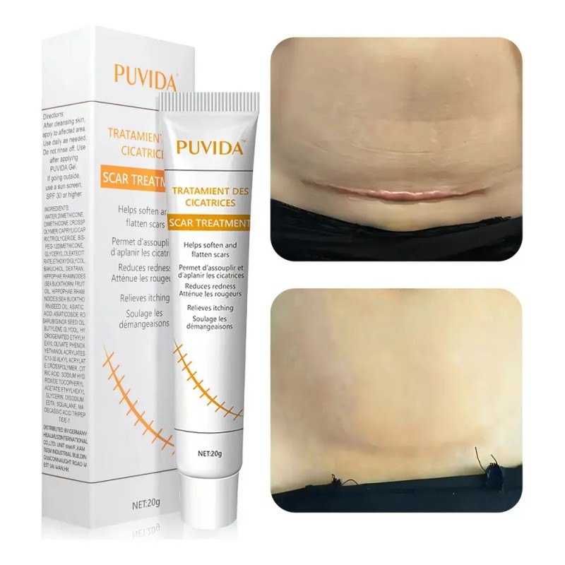 Gel Puvida Cicatrizante para Rostro y Cuerpo, de Día y