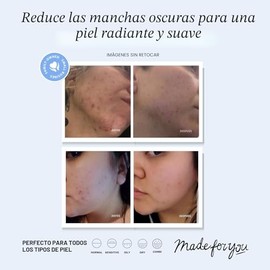 Suero con vitamina C y ácido hialurónico para cara y ojos – Cuidado orgánico de la piel con ingredientes naturales para el acné, antiarrugas, antienve