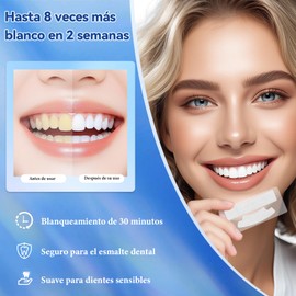 tiras blanqueadoras de dientes,tiras blanqueadoras dientes,tiras blanqueadoras，15 Pares (30 Tiras) para Blanquear Dientes y Eliminar Manchas