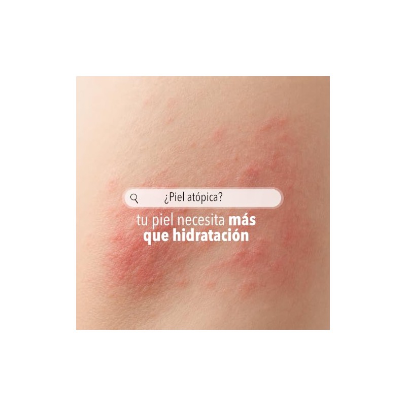 Derman Atopi Calm Crema Corporal │ Urea-D 5% + Avena
