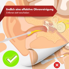 NEUMANN® Reusable Ear Cleaning Set - Stainless Steel - Handy Storage Box (Loose, Spiral & Spoon Shape) Premium Earwax Remover for Adults [Black Anodized]