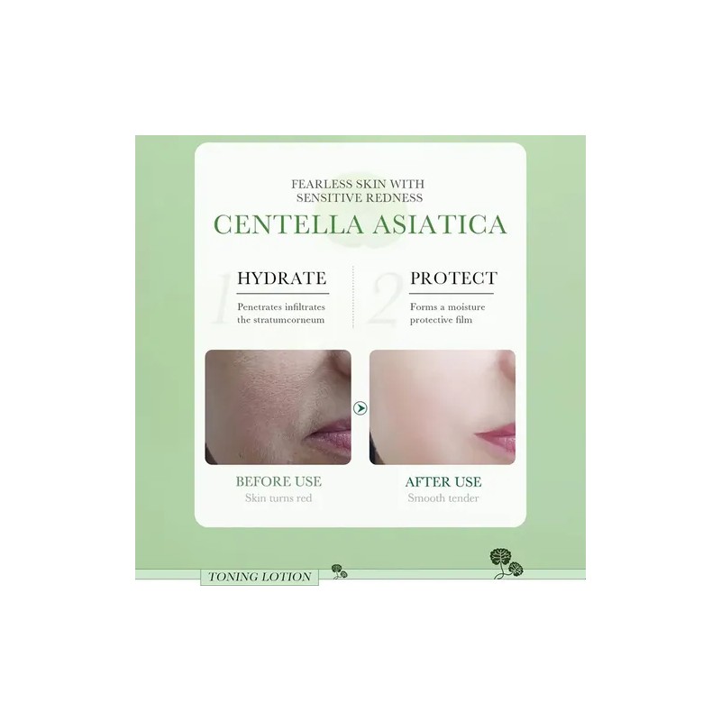 .yui Bioaqua Centella Asiatica Calmante Reparación De .sv