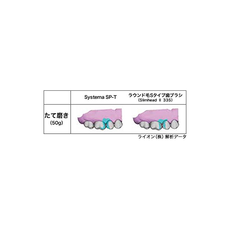 Lion Dental System SP-T Toothbrush (4 Pack)